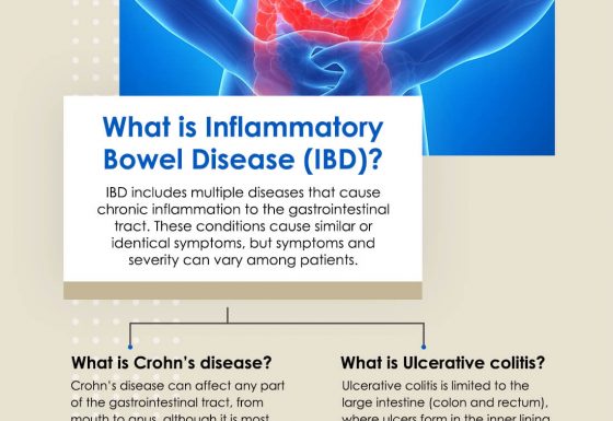 Know IBD