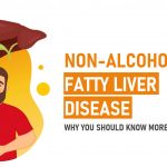Non-Alcoholic Fatty Liver Disease – Why You Should Know More About It